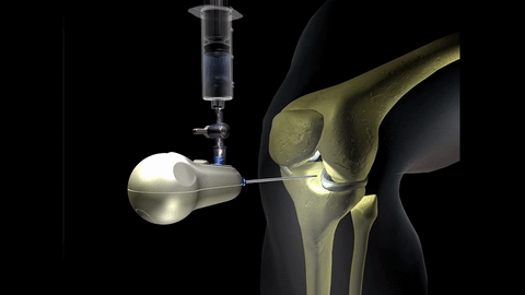 Trice Medical's mi-eye+ medical diagnostics device.