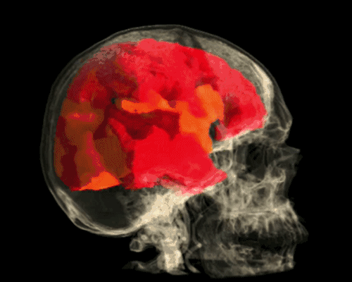 Animation of a brain firing synapses