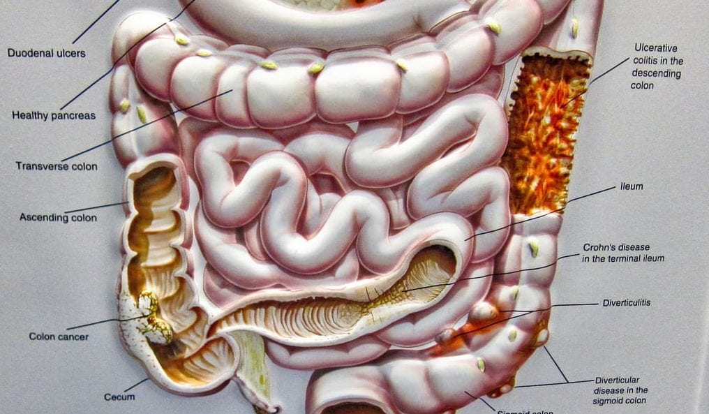 Model of a colon