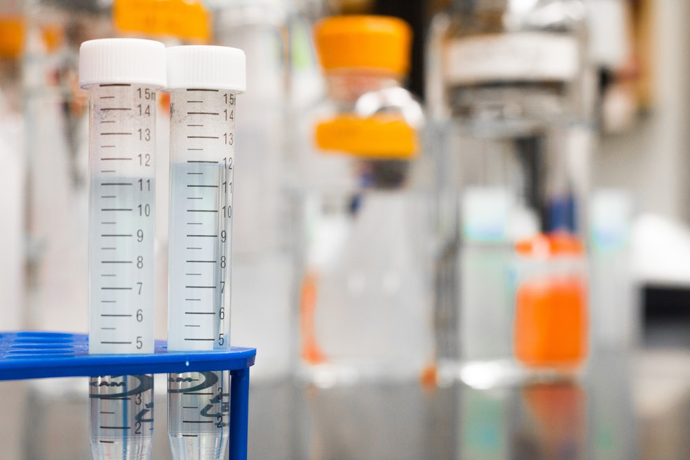 Test tubes in a wet lab.