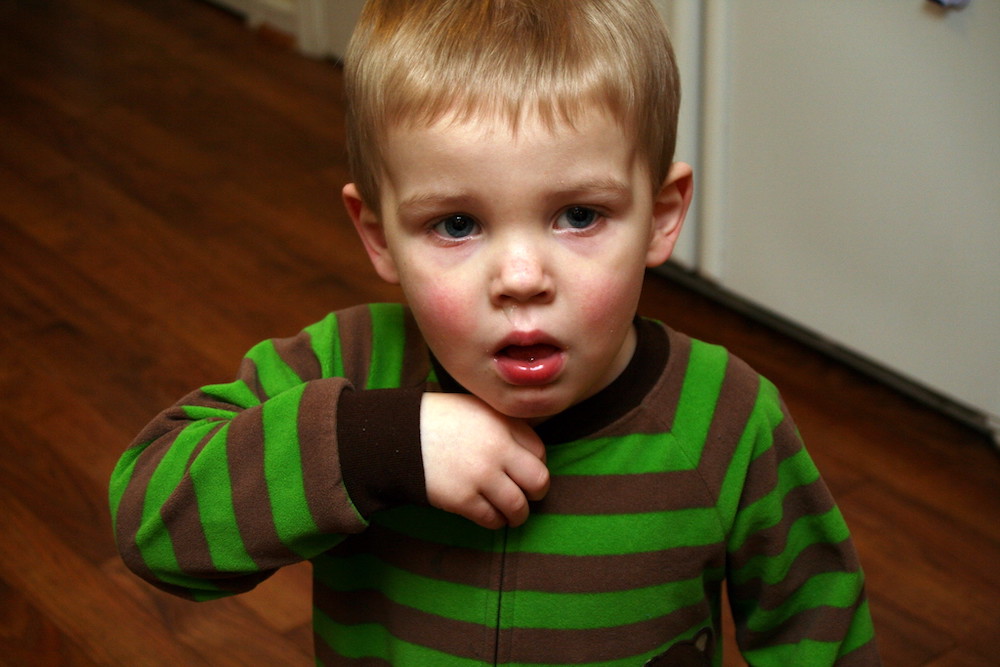 Child with green and brown striped shirt and red cheeks and nose in front of brown floor