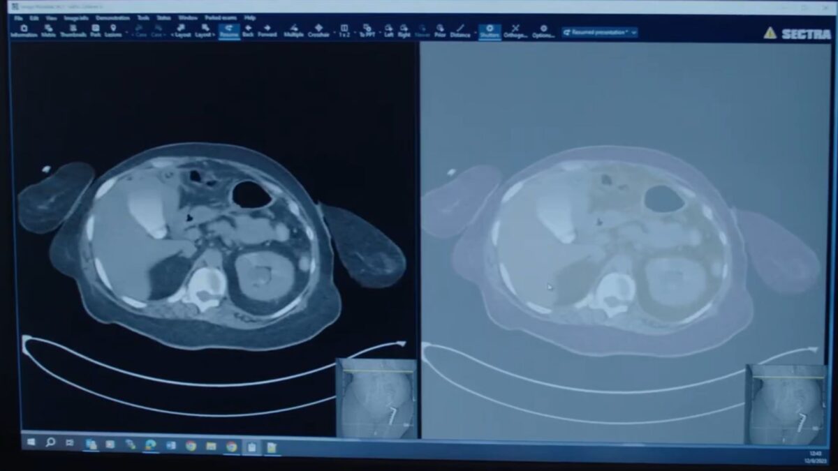 AI technologies that help doctors improve medical imaging processes