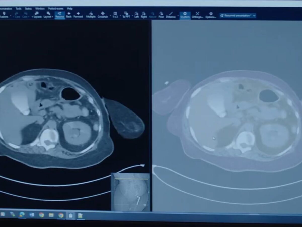 AI technologies that help doctors improve medical imaging processes